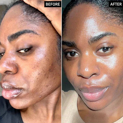 Radiant Glow Duo Peeling Kit