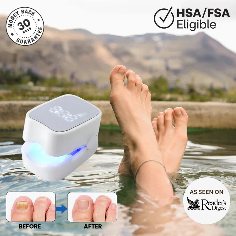 Walimo Pro™ - Nail Fungus Laser Device